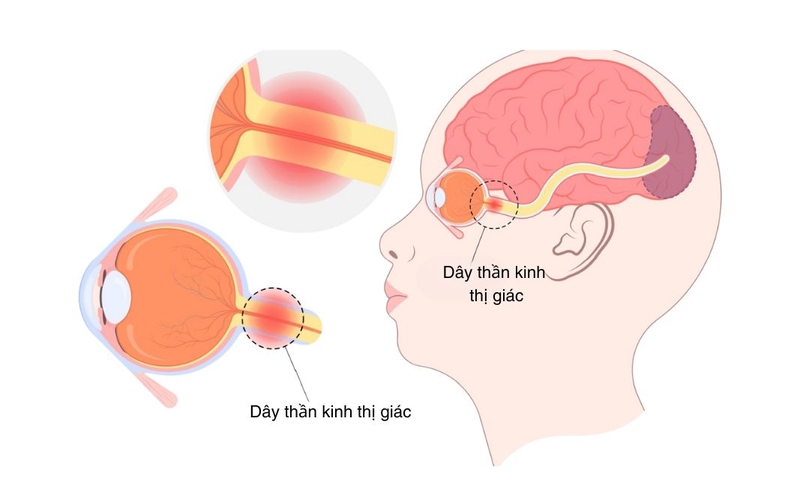 day_than_kinh_thi_giac_co_nhiem_vu_gi_2_337606c7d8.jpg (95 KB)
