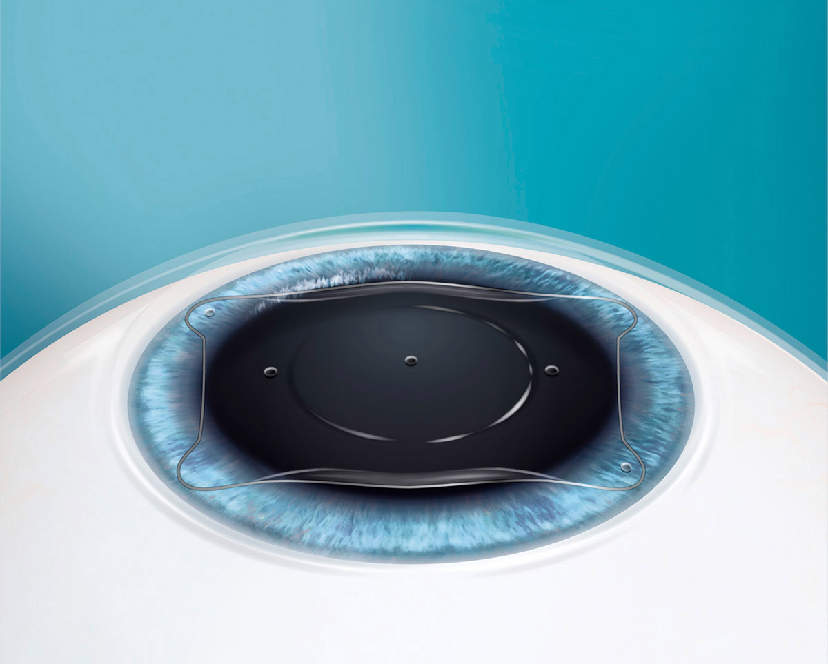 evoeye.jpg (112 KB)