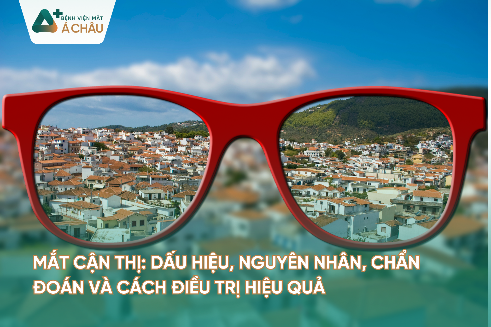 MẮT CẬN THỊ: DẤU HIỆU, NGUYÊN NHÂN, CHẨN ĐOÁN VÀ CÁCH ĐIỀU TRỊ HIỆU QUẢ