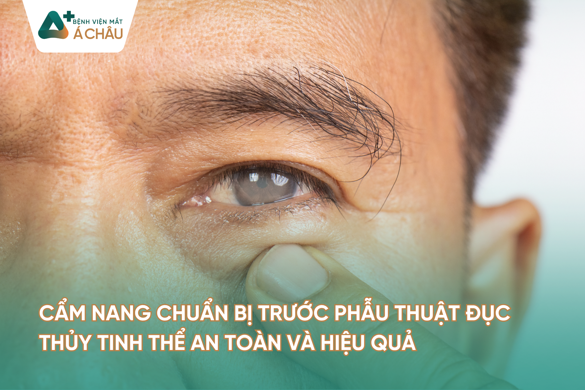 CẨM NANG CHUẨN BỊ TRƯỚC PHẪU THUẬT ĐỤC THỦY TINH THỂ AN TOÀN VÀ HIỆU QUẢ
