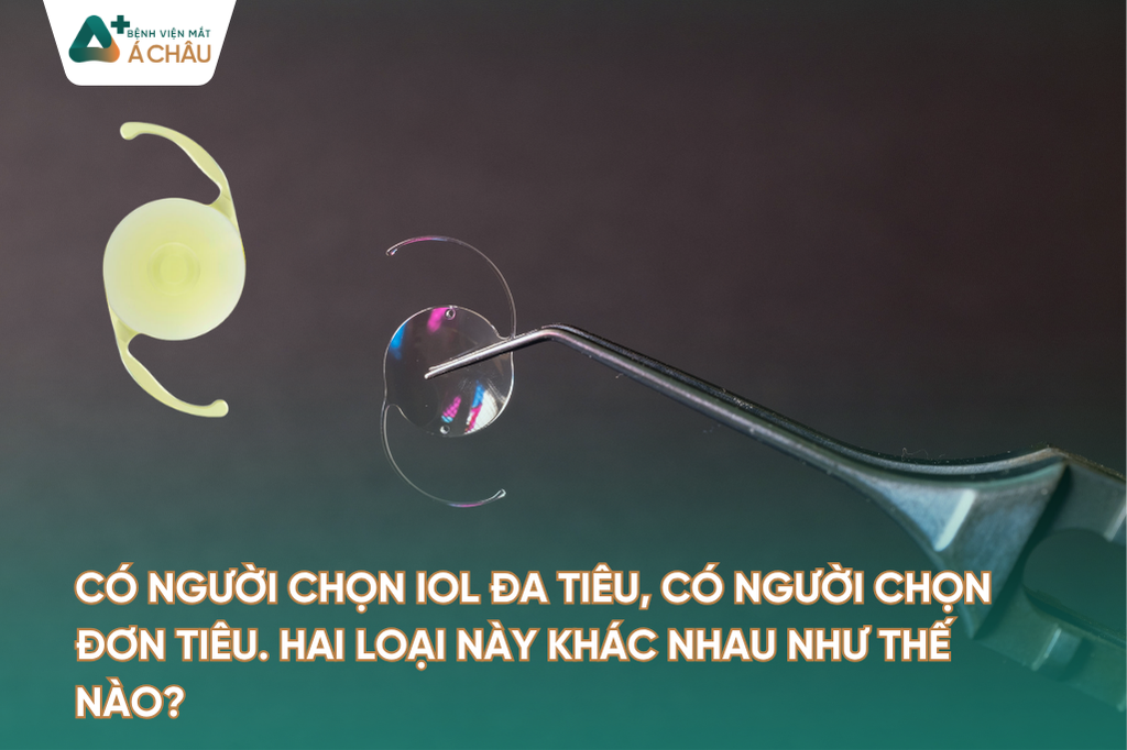Có người chọn IOL Đa tiêu, có người chọn Đơn tiêu. Hai loại này khác nhau như thế nào?