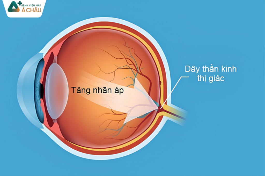 tang-nhan-ap.png (669 KB)