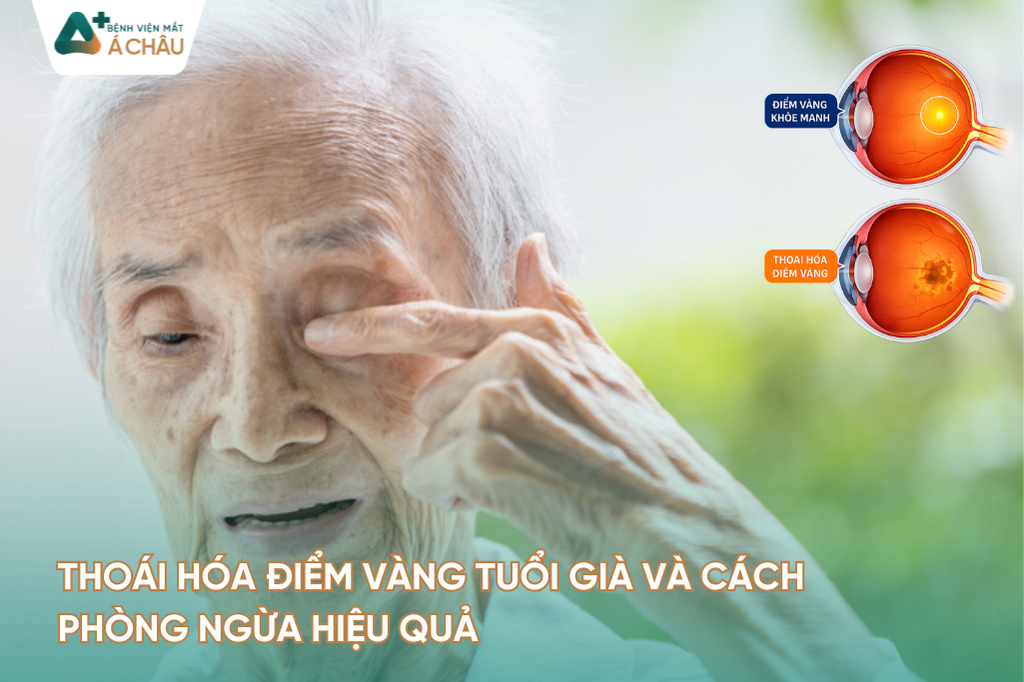 Thoái Hóa Điểm Vàng Tuổi Già Và Cách Phòng Ngừa Hiệu Quả