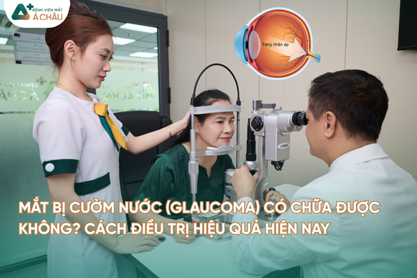 Mắt Bị Cườm Nước (Glaucoma) Có Chữa Được Không? Cách điều trị hiệu quả hiện nay