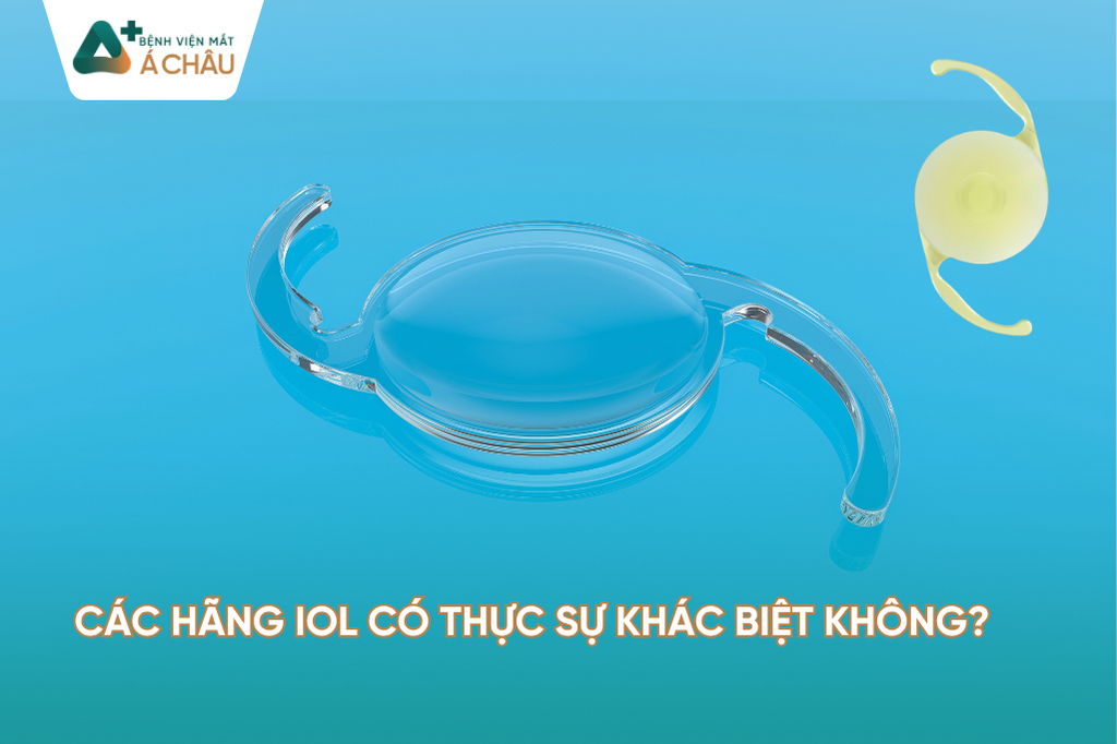 Các hãng IOL khác nhau như thế nào? Chuyên gia giải đáp